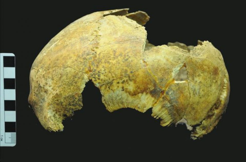 Εγχείρηση εγκεφάλου 5.000 χρόνια πριν – Τι αποκαλύπτει κρανίο που βρέθηκε στην Κριμαία! - ΔΙΕΘΝΗ
