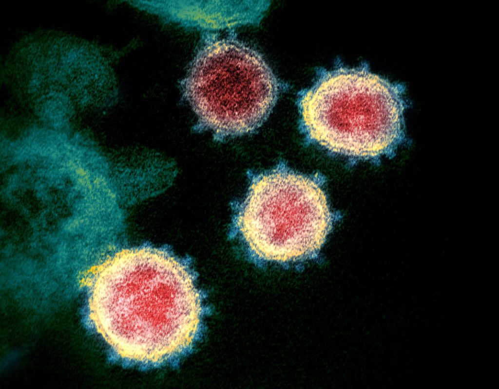 Coronavirus_SARS-CoV-2-NIAID-RML-CC-BY-2.0-1068x834