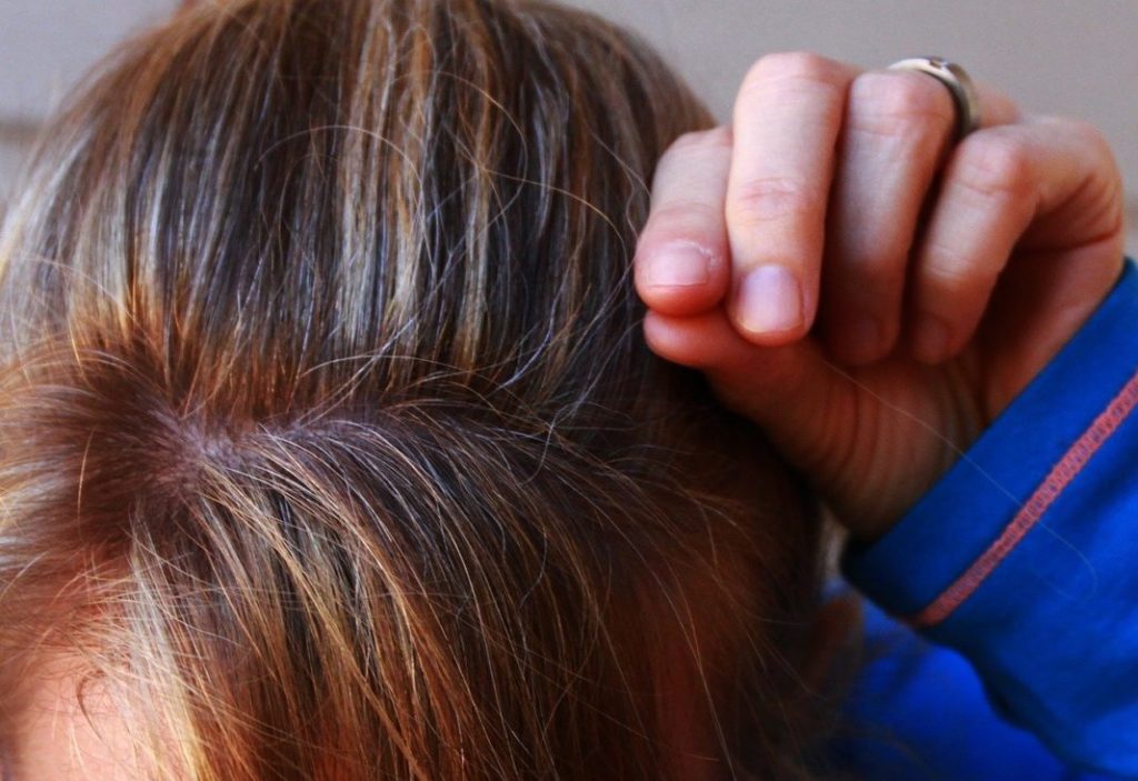 Το γκριζάρισμα των μαλλιών που οφείλεται στο άγχος είναι αναστρέψιμο - ΠΕΡΙΕΡΓΑ