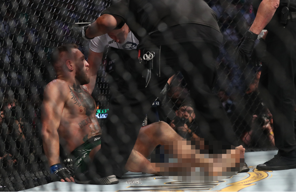 UFC: Ανατριχιαστικός τραυματισμός του ΜακΓκρέγκορ – Υπέστη κάταγμα στο πόδι [σκληρές εικόνες] - ΑΘΛΗΤΙΚΑ