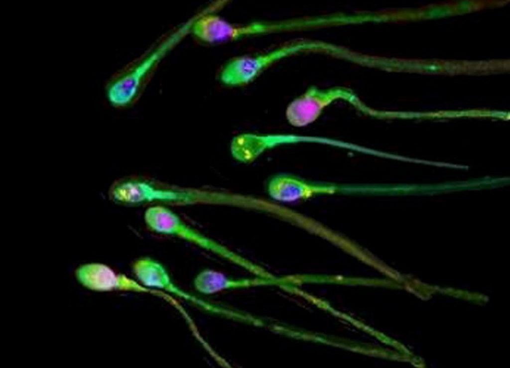 Πόσο επηρεάζουν το σπέρμα τα εμβόλια mRNA: Τι δείχνουν οι έρευνες - ΕΛΛΑΔΑ