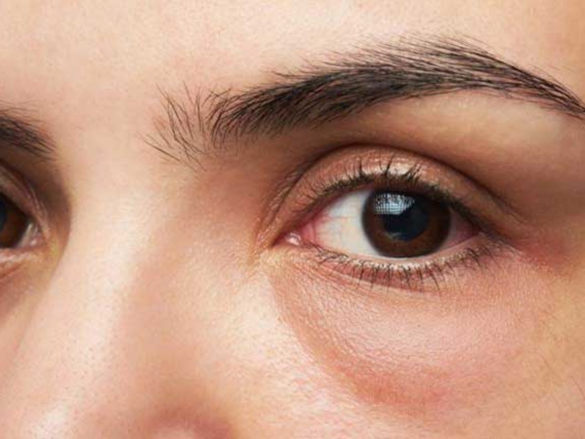 Τα μάτια μαρτυρούν τον κίνδυνο πρόωρου θανάτου – Τι έδειξε έρευνα - ΕΠΙΣΤΗΜΗ