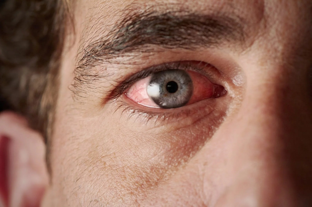 Τα μάτια μαρτυρούν τον κίνδυνο πρόωρου θανάτου – Τι έδειξε έρευνα - ΕΠΙΣΤΗΜΗ