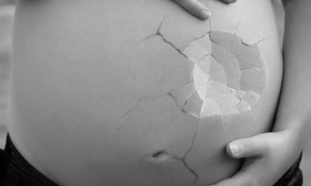 Αδιανόητο: Λήστεψε και χτύπησε έγκυο προκαλώντας της αποβολή - ΝΕΑ