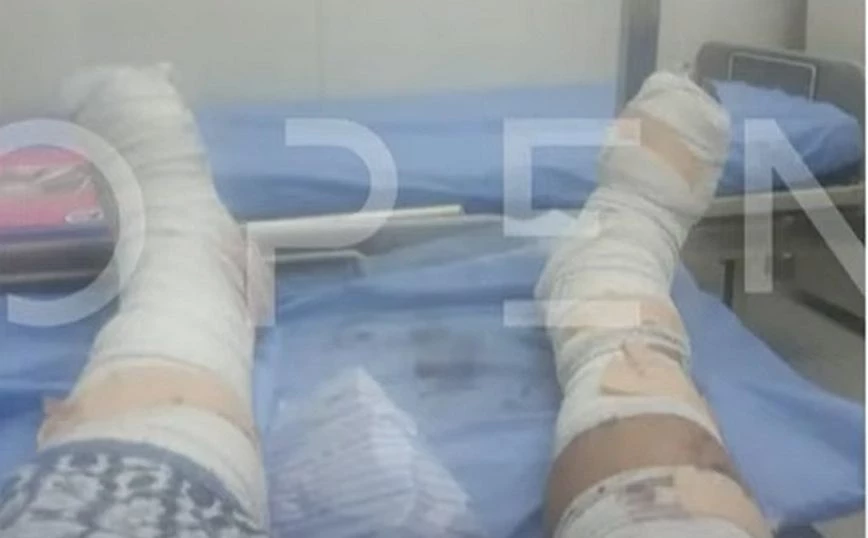 Σουδάν: Φωτογραφία ντοκουμέντο από Έλληνα τραυματία – Οι γιατροί δεν μπορούν να φτάσουν στο νοσοκομείο - ΝΕΑ