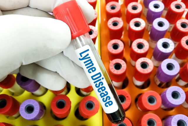 Τι-είναι-η-νόσος-του-lyme-που-πάσχει-ο-Τζάστιν-Τίμπερλεϊκ-–-Πώς-μεταδίδεται,-συμπτώματα-και-θεραπεία