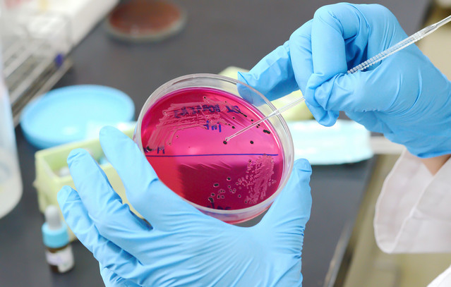 Σαλμονέλα-σε-αμφιλεγόμενο-τρόφιμο-μόλυνε-160-ανθρώπους