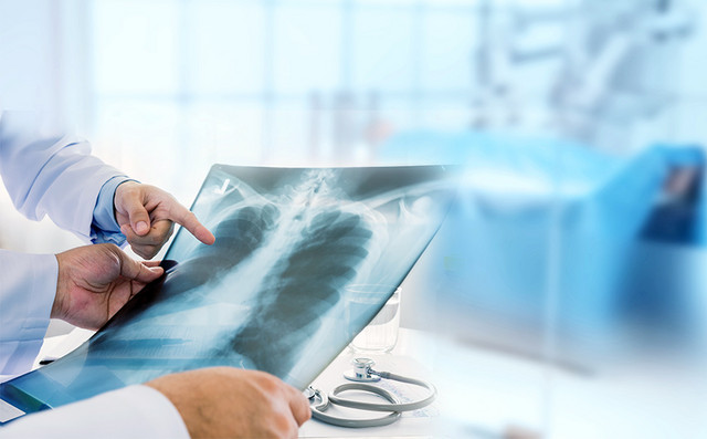 Διεθνής-διάκριση-για-την-Ελλάδα:-Πρωτοποριακή-θεραπεία-καρκίνου-του-πνεύμονα-με-ελληνική-συμμετοχή