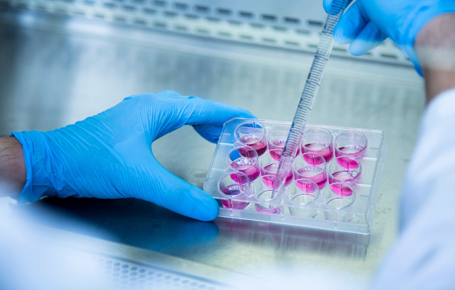 Πρωτεΐνη-που-αντιστρέφει-τη-γήρανση-σε-κυτταρικό-επίπεδο-ανακάλυψαν-επιστήμονες