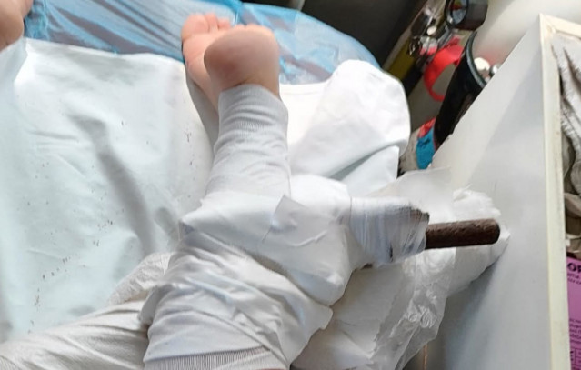 Τραυματίστηκε-από-ομπρέλα-στην-παραλία:-«Θύμα»-των-ισχυρών-ανέμων-26χρονη-στη-Χαλκιδική