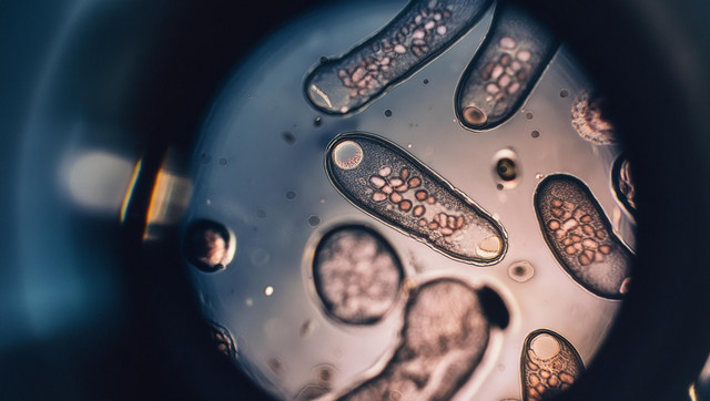 Θανατηφόρο-παράσιτο-που-τρώει-σάρκα-εντοπίστηκε-για-πρώτη-φορά-σε-άνθρωπο-στις-ΗΠΑ-–-Τι-είναι-το-screwworm;