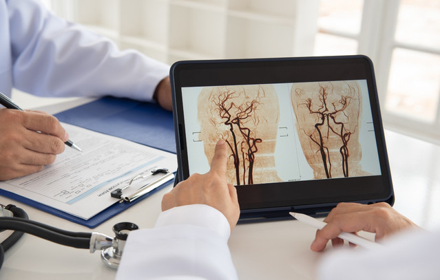 Αυτοί-οι-4-παράγοντες-αυξάνουν-τον-κίνδυνο-εγκεφαλικού,-σύμφωνα-με-νέα-έρευνα