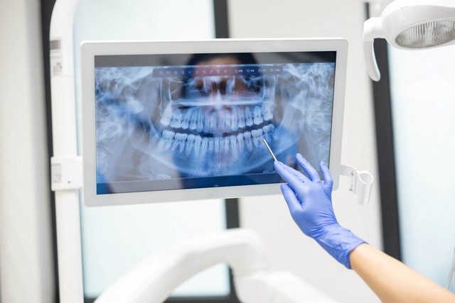 Μικροπλαστικά-και-οδοντιατρική:-Τι-γίνεται-με-όλο-αυτό-το-πλαστικό-που-βάζουμε-στο-στόμα-μας;