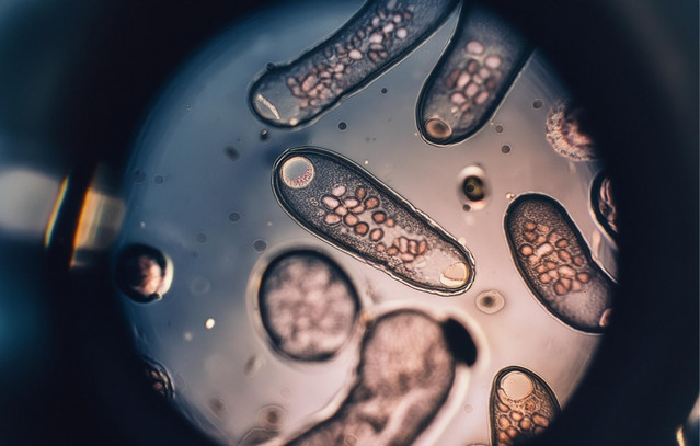 Η-heidi-klum-υποστηρίζει-ότι-όλοι-έχουμε-παράσιτα-εντέρου-–-Τι-λέει-όμως-η-επιστήμη;