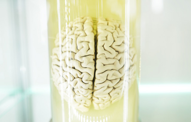 Κινέζοι-επιστήμονες-θέλουν-να-μελετήσουν-τον-εγκέφαλο-του-Αϊνστάιν-για-να-ανακαλύψουν-την-κυτταρική-βάση-της-ιδιοφυΐας-του