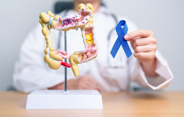 4-καθημερινές-συνήθειες-για-να-μειώσετε-τον-κίνδυνο-καρκίνου-παχέος-εντέρου