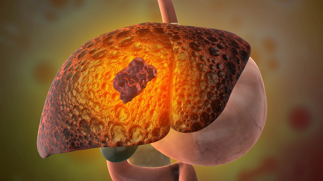 Αυξημένα-ηπατικά-ένζυμα-και-τι-μπορεί-να-σημαίνουν