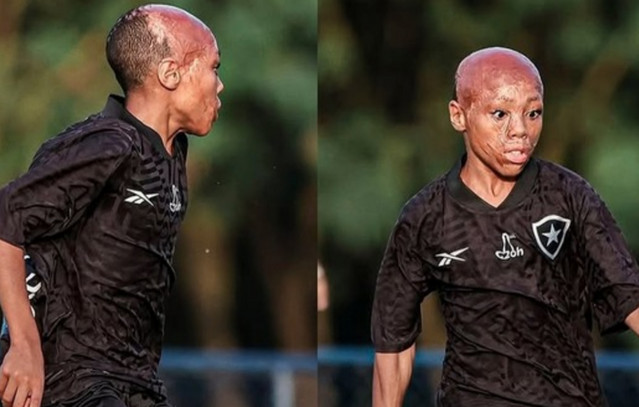 Από-τα-νοσοκομεία-στην-ακαδημία-της-Μποταφόγκο:-Η-συγκλονιστική-ιστορία-του-Μπερνάρντο-Λόπες-που-νίκησε-το-θάνατο