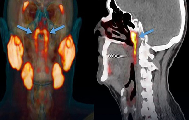 Επιστήμονες-ανακάλυψαν-κατά-λάθος-νέο-όργανο-στο-ανθρώπινο-σώμα