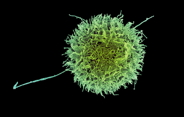 Οι-επιστήμονες-ανακαλύπτουν-«φυσικό-δολοφόνο»-του-καρκίνου-που-είναι-ασφαλέστερος-και-πιο-αποτελεσματικός-από-τις-τυπικές-θεραπείες