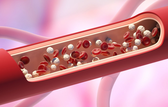 Κάθε-6-δευτερόλεπτα-χάνεται-μία-ζωή-από-επιπλοκές-θρόμβων