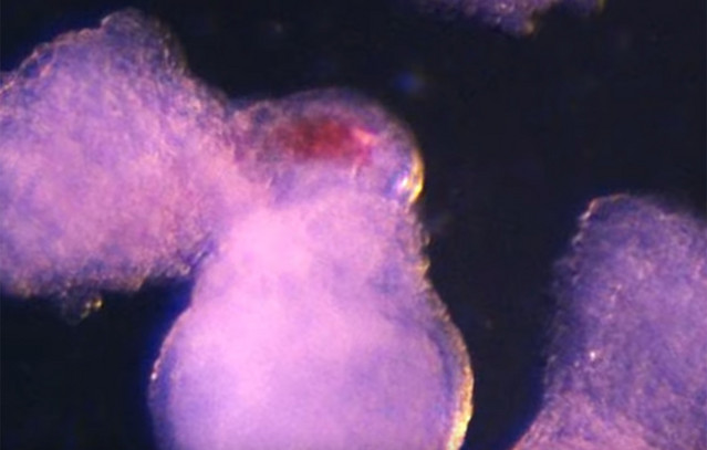 Επαναστατική-εργαστηριακή-ανακάλυψη:-Επιστήμονες-καλλιεργούν-ανθρώπινο-αίμα-χρησιμοποιώντας-εμβρυοειδή-βλαστοκύτταρα