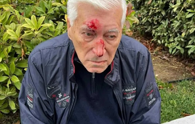 Θεσσαλονίκη:-82χρονος-καταγγέλλει-πως-έπεσε-θύμα-ξυλοδαρμού-–-Τον-χτύπησε-με-γροθιές-γιατρός-στη-μέση-του-δρόμου