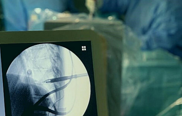 Πρωτοποριακές-Ενδοσκοπικές-και-Ελάχιστα-Επεμβατικές Χειρουργικές-Τεχνικές-(miss)-για-όλες-τις-παθήσεις-της-Σπονδυλικής-Στήλης