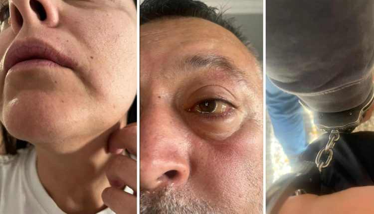 Έβαλαν-χειροπέδες-και-κακοποίησαν-ζευγάρι-Τούρκων-τουριστών