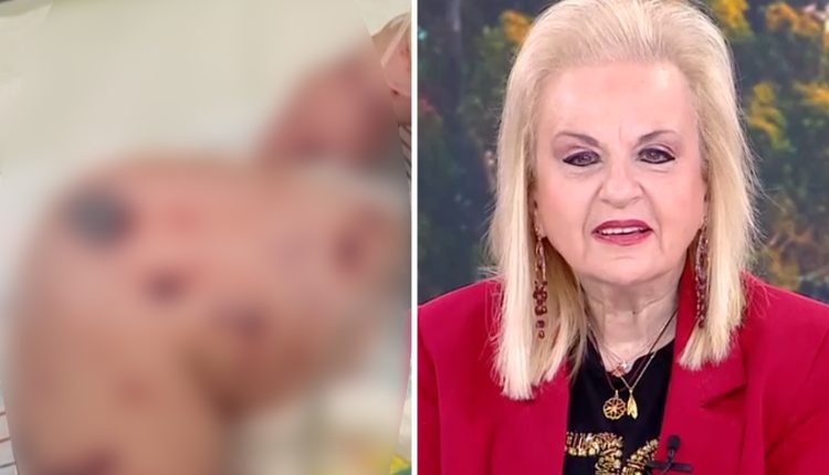 Παγώνη-για-το-βρέφος-στη-Ζάκυνθο:-Δεν-έχουμε-θανάτους-από-ιογενή-μηνιγγίτιδα-–-Από-φωτογραφίες-δεν-μπορούμε-να-βγάζουμε-διαγνώσεις