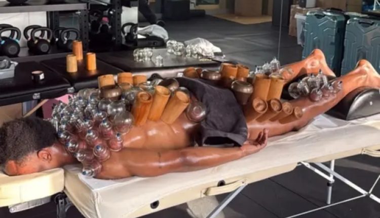 Γιουβέντους:-Ο-Οπέντα-δοκιμάζει-τα-πάντα-για-να-βρει-το-γκολ-–-Ακόμη-και-τη-«θεραπεία-με-βεντούζες»