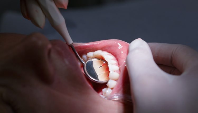 Πόσο-συχνά-πηγαίνουν-οι-Έλληνες-στον-οδοντίατρο;-Και-τι-μπορούν-να-κάνουν-όσοι-φοβούνται;-Ένας-οδοντίατρος-εξηγεί