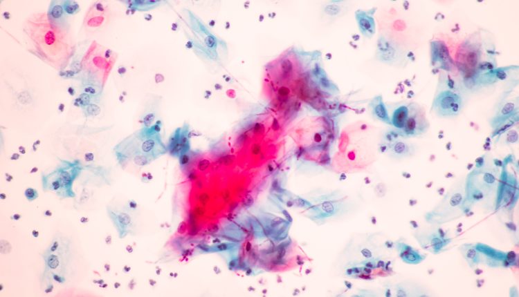 Ανησυχία-για-τα-«superbugs»-στη-Νέα-Υόρκη-–-Αύξηση-των-κρουσμάτων-του-candida-auris-και-προειδοποιήσεις-ειδικών-για-την-ανθεκτικότητα-στα-αντιβιοτικά