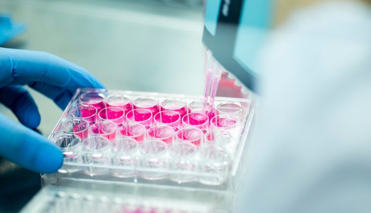 Η-νέα-προσέγγιση-στον-καρκίνο-του-προστάτη-που-μειώνει-τις-παρενέργειες-της-βασικής-θεραπείας