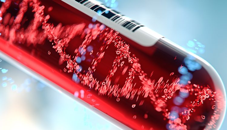 Αύξηση-αιματολογικών-καρκίνων-έπειτα-από-τη-θεραπεία-άλλου-καρκίνου-διαπιστώνει-έρευνα