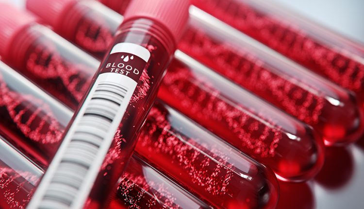Ερευνητές-αναπτύσσουν-μια-απλή-εξέταση-αίματος-για-την-ανίχνευση-καρκίνων-και-άλλων-ασθενειών