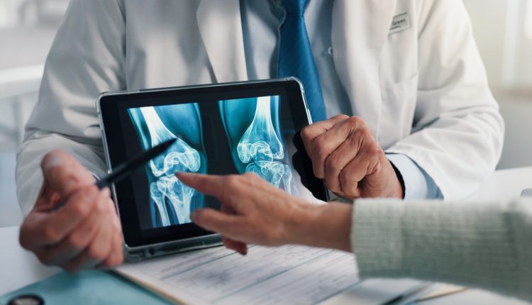 Ανησυχείτε-για-την-οστεοπόρωση;-Τι-μπορεί-να-σας-βοηθήσει-πέρα-από-τη-φαρμακευτική-αγωγή