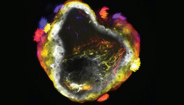 Νευρορομπότ:-Η-νέα-γενιά-«ζωντανών»-μηχανών-με-εγκέφαλο-αλλάζει-τα-δεδομένα-στην-επιστήμη