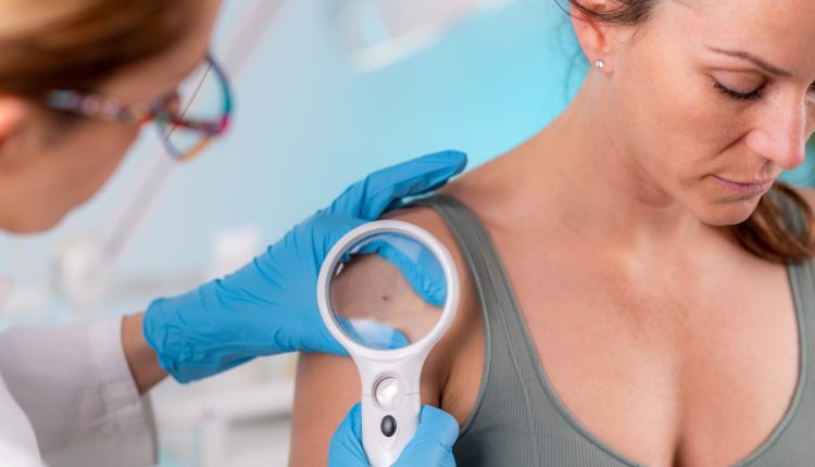 Οι-δερματολόγοι-αποκαλύπτουν-το-νούμερο-1-σημάδι-του-καρκίνου-του-δέρματος-–-και-είναι-ύπουλο