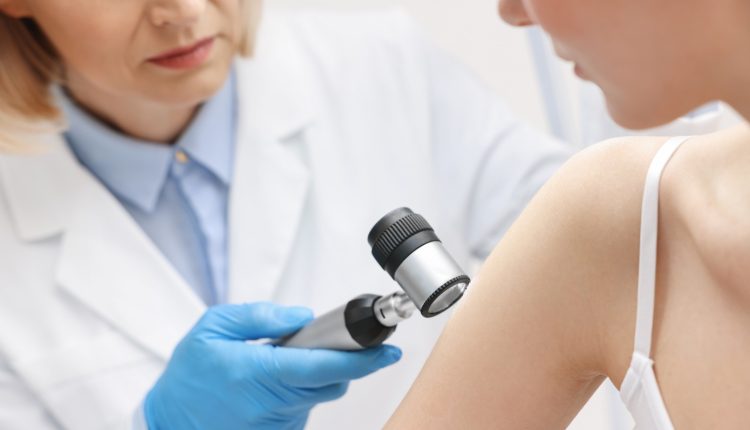 Δερματικό-επίθεμα-σκοτώνει-τα-καρκινικά-κύτταρα-του-μελανώματος-χωρίς-να-χρειάζεται-χειρουργείο