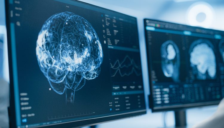 Τι-είναι-το-«θαυματουργό»-γραφένιο-που-φέρνει-ελπίδα-για-Πάρκινσον-και-επιληψία