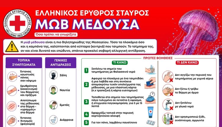 Καλοκαίρι-με-ασφάλεια:-Τι-να-κάνετε-αν-σας-τσιμπήσει-μωβ-μέδουσα