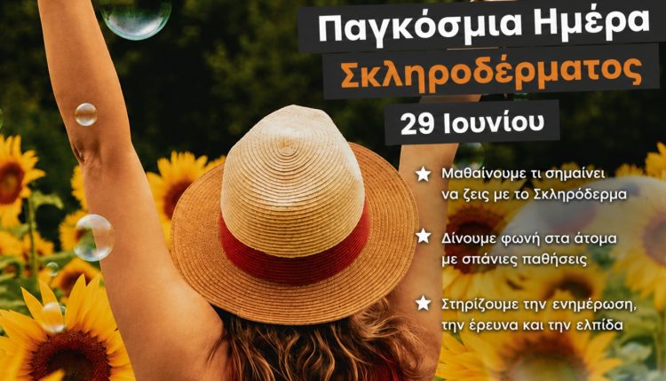 Δεν-είναι-απλώς-κρύα-χέρια:-Τα-πρώτα-σημάδια-του-Σκληροδέρματος-που-δεν-πρέπει-να-αγνοούμε