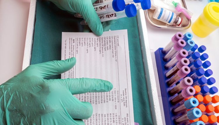 Στρατηγικό-άλμα-για-την-angelini-pharma-–-Ολοκληρώνει-την-εξαγορά-της-catalyst-και-ισχυροποιείται-στην-παγκόσμια-αγορά