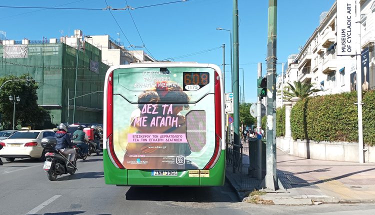 Τα…-«αυτοάγνωστα» αυτοάνοσα-φλεγμονώδη-δερματικά-νοσήματα ΔΕΣ-ΤΑ-ΜΕ-ΑΓΑΠΗ